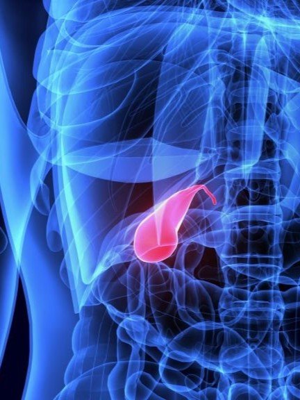 Laparoscopic gallbladder surgery London